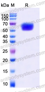Recombinant Human CD124/IL4R/IL-4R&alpha; Protein, C-Fc (Active)