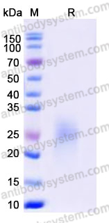 Recombinant Human EDNRB/ETRB Protein, C-His (Active)