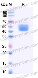 Recombinant Human CD123/IL3RA Protein, C-His (Active)