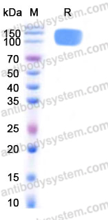 Recombinant Human CD26/DPP4 Protein, N-Fc (Active)