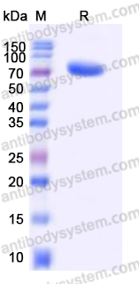 Recombinant Human EPHA8 Protein, C-His (Active)