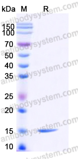 Recombinant Human CD154/CD40LG/TNFSF5 Protein, Tag free (Active)