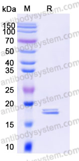 Recombinant Human CD154/CD40LG/TNFSF5 Protein, Tag free (Active)