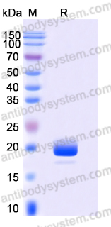 Recombinant Human CD154/CD40LG/TNFSF5 Protein, N-His (Active)