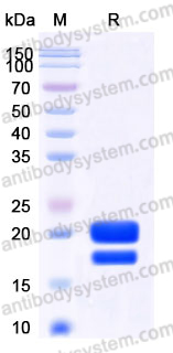 Recombinant Human CD154/CD40LG/TNFSF5 Protein, N-His-Flag (Active)