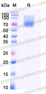 Recombinant Human AXL/UFO Protein, C-His (Active)