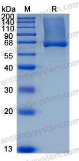 Recombinant Human GPC1 Protein, C-His (Active)