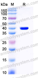 Recombinant Human CA8 Protein, C-His (Active)