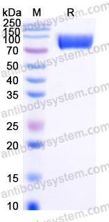 Recombinant Human CD309/KDR/VEGFR-2 Protein, C-His (Active)
