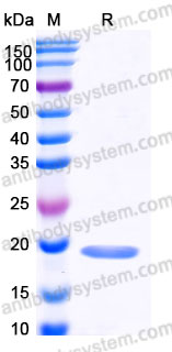 Recombinant Human SNCA Protein, N-His (Active)