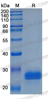 Recombinant Human NBL1 Protein, C-His (Active)