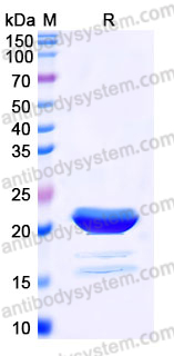 Recombinant Human TNFSF9/4-1BBL Protein, C-His (Active)