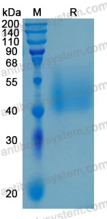 Recombinant Human CD86/B7-2 Protein, C-His (Active)