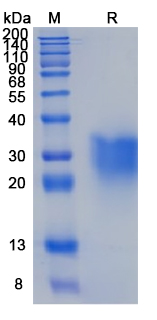 Recombinant Human GLP1R Protein, C-His (Active)