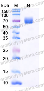 Recombinant Human GLP1R Protein, C-Fc (Active)