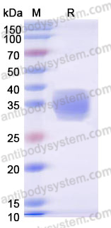 Recombinant Human GLP1R Protein, C-His (Active)