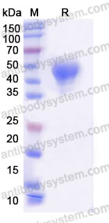 Recombinant Human CD158a/KIR2DL1 Protein, C-His (Active)