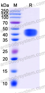 Recombinant Human CD158b2/KIR2DL3 Protein, C-His (Active)