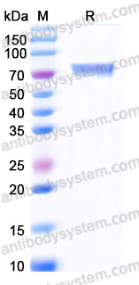 Recombinant Human CD158b2/KIR2DL3 Protein, C-Fc (Active)