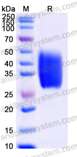 Biotinylated Human GCGR (N-ECD) Protein, C-His-Avi