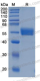 Recombinant Human NPTX2 Protein, C-His (Active)