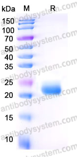 Recombinant Human CD178/FASLG/TNFSF6 Protein, N-His (Active)