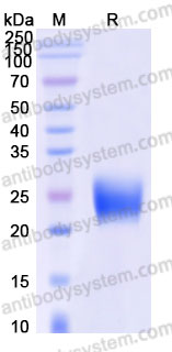 Biotinylated Human GIPR/GIP-R (N-ECD) Protein, C-His-Avi