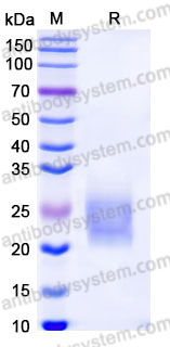 Recombinant Human GIPR/GIP-R Protein, C-His (Active)