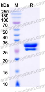 Recombinant Human VEGFC Protein, C-His (Active)