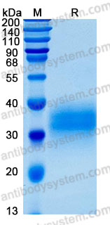 Recombinant Human EFNB2 Protein, C-His (Active)