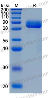 Recombinant Human EPHA5 Protein, C-His (Active)