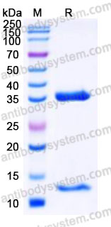 Recombinant Human FcRn Heterodimer, C-His (Active)