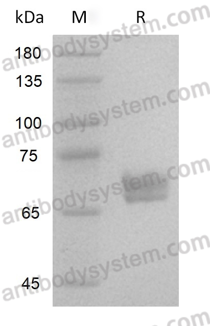Recombinant Human WNT3A Protein (Active)