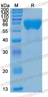 Recombinant Human BACE1 Protein, C-His (Active)