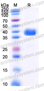 Recombinant Human CD184/CXCR4 Protein, N-Fc (Active)