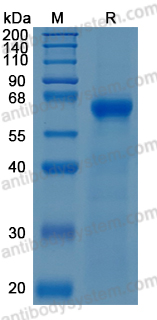 Recombinant Human CD156a/ADAM8 Protein, C-His (Active)