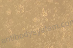 Recombinant Human CD83 Protein, C-His (Active)