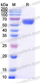 Recombinant Human IL1RL1/ST2 Protein, C-His (Active)
