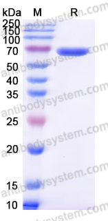 Recombinant Human ROR1/NTRKR1 Protein, C-His (Active)