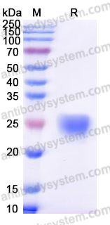 Recombinant Human ROR1/NTRKR1 Protein, C-His (Active)