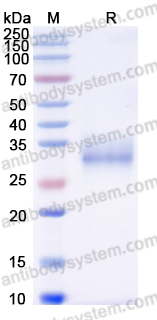 Recombinant Human CD137/TNFRSF9/4-1BB Protein, C-His (Active)