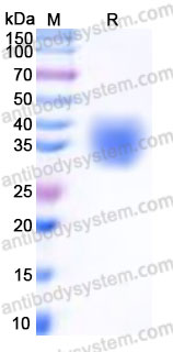 Recombinant Human CD47/MER6 Protein, C-His (Active)