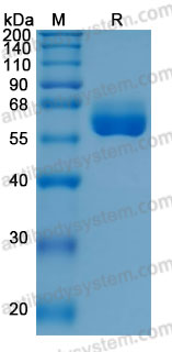 Recombinant Human IL15 & IL15RA Protein, C-hFc (Active)