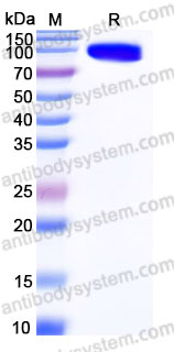 Recombinant Human PTK7/CCK-4 Protein, C-His (Active)