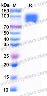 Recombinant Human TPBG/5T4 Protein, C-mFc (Active)