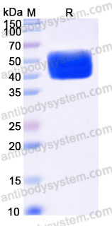 Recombinant Human CDw210a/IL10RA Protein, C-His (Active)