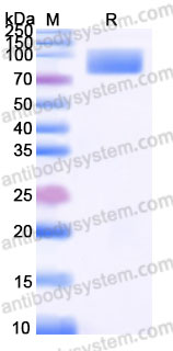 Recombinant Human CD166/ALCAM Protein, C-His (Active)