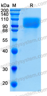 SDS-PAGE for Recombinant Human GPNMB Protein, C-His (Active) ?>