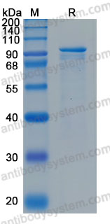 Recombinant Human POSTN/OSF-2 Protein, C-His (Active)