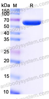 Recombinant Human EPHA7 Protein, C-His (Active)